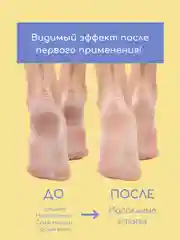 SKINTERRIA Средство для педикюра от мозолей и натоптышей Кератолитик c мочевиной 30% 250мл