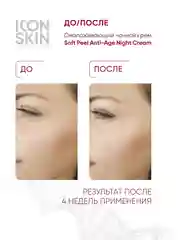 ICON SKIN Омолаживающий ночной крем Soft Peel, 30 мл
