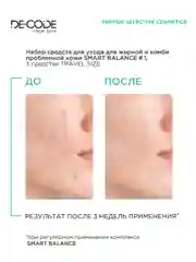 DECODE / Набор от прыщей, воспалений с ниацинамидом и пептидом для жирной и комби кожи