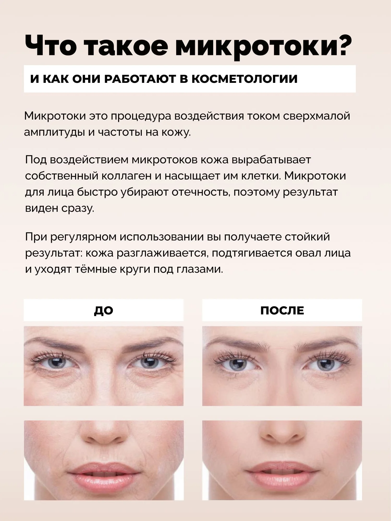 Аппарат для микротоковой терапии MT GESS
