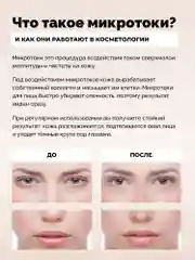 Аппарат для микротоковой терапии MT GESS