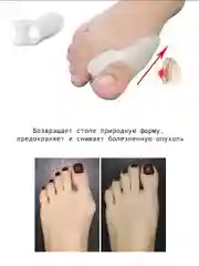 Вальгусный гелевый фиксатор, силиконовый бурсопротектор большого пальца стопы
