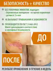 Мазь крем Акрустал негормональный для кожи от псориаза, экземы, дерматита Медовая Формула