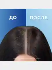 Шампунь Head&Shoulders "Цитрусовая свежесть" против перхоти, 200 мл