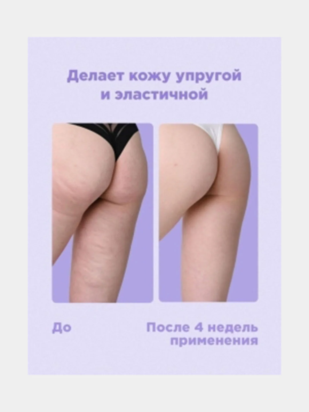 Антицеллюлитный комплекс
