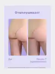 Антицеллюлитный комплекс