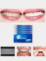 Отбеливающие полоски для зубов 3D White, 7 штук