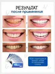 Отбеливающее средство для зубов 3D White Полоски для отбеливания зубов КУРС НА 7 ДНЕЙ