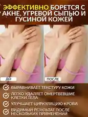 Массажная рукавица мочалка кесе для пилинга лица и тела варежка