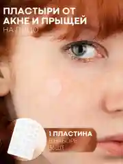 Патчи от прыщей, акне КАРТОФАН, пластырь для проблемной кожи лица, средство против угрей