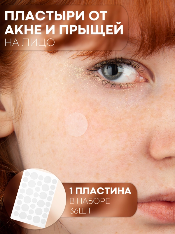 Патчи от прыщей, акне КАРТОФАН, пластырь для проблемной кожи лица, средство против угрей
