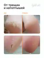Набор для педикюра EpilProfi: гель и крем для ног с мочевиной, пемза в комплекте