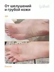 Набор для педикюра EpilProfi: гель и крем для ног с мочевиной, пемза в комплекте