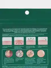 Лесной зеленый противовоспалительные патчи от прыщей и акне Acne Pimple Patch