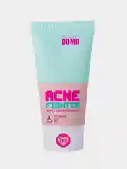 Тональный крем BEAUTY BOMB Acne fighter, тон 03, 25 мл