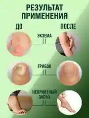Мазь от псориаза, от грибка ногтей на ногах, мох сфагнум эмульсия / 108 трав, 100 г