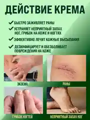 Мазь от псориаза, от грибка ногтей на ногах, мох сфагнум эмульсия / 108 трав, 100 г