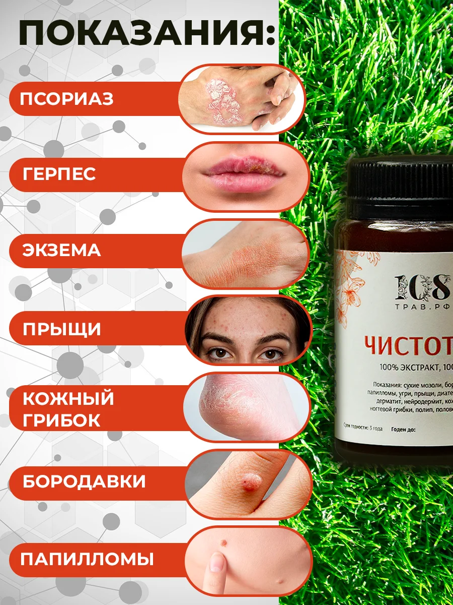 Крем-эмульсия от прыщей и угрей, 100% натуральный чистотел, 108 трав