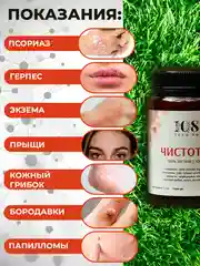 Крем-эмульсия от прыщей и угрей, 100% натуральный чистотел, 108 трав