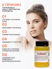 Мазь от псориаза, от прыщей на лице, от грибка ногтей / Календула, Соффид, 100 гр