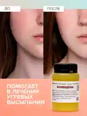 Мазь от псориаза, от прыщей на лице, от грибка ногтей / Календула, Соффид, 100 гр