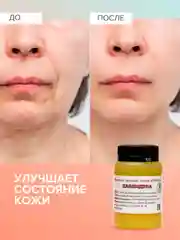 Мазь от псориаза, от прыщей на лице, от грибка ногтей / Календула, Соффид, 100 гр