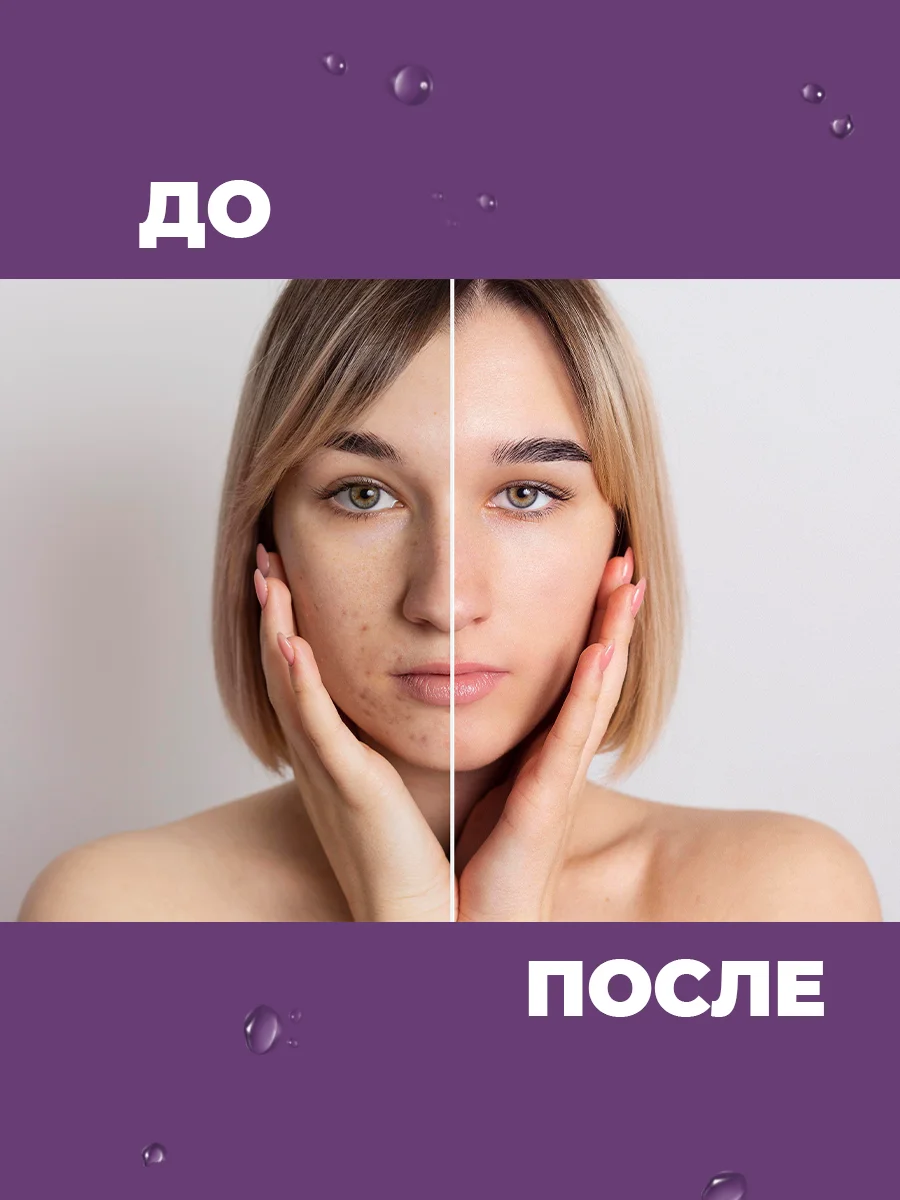 Крем для лица увлажняющий, антивозрастной с муцином улитки, от акне и морщин/Улитка 100г