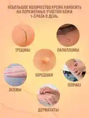 Экстракт "Молочай" крем от прыщей, выводит веснушки, бородавки,от псориаза,воспаления/100г