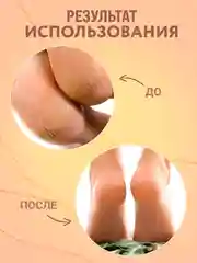 Экстракт "Молочай" крем от прыщей, выводит веснушки, бородавки,от псориаза,воспаления/100г