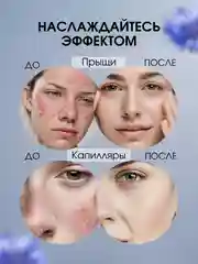 Экстракт Василёк эффективная мазь от прыщей, угрей, капиллярных сеточек и перхоти, 100 г