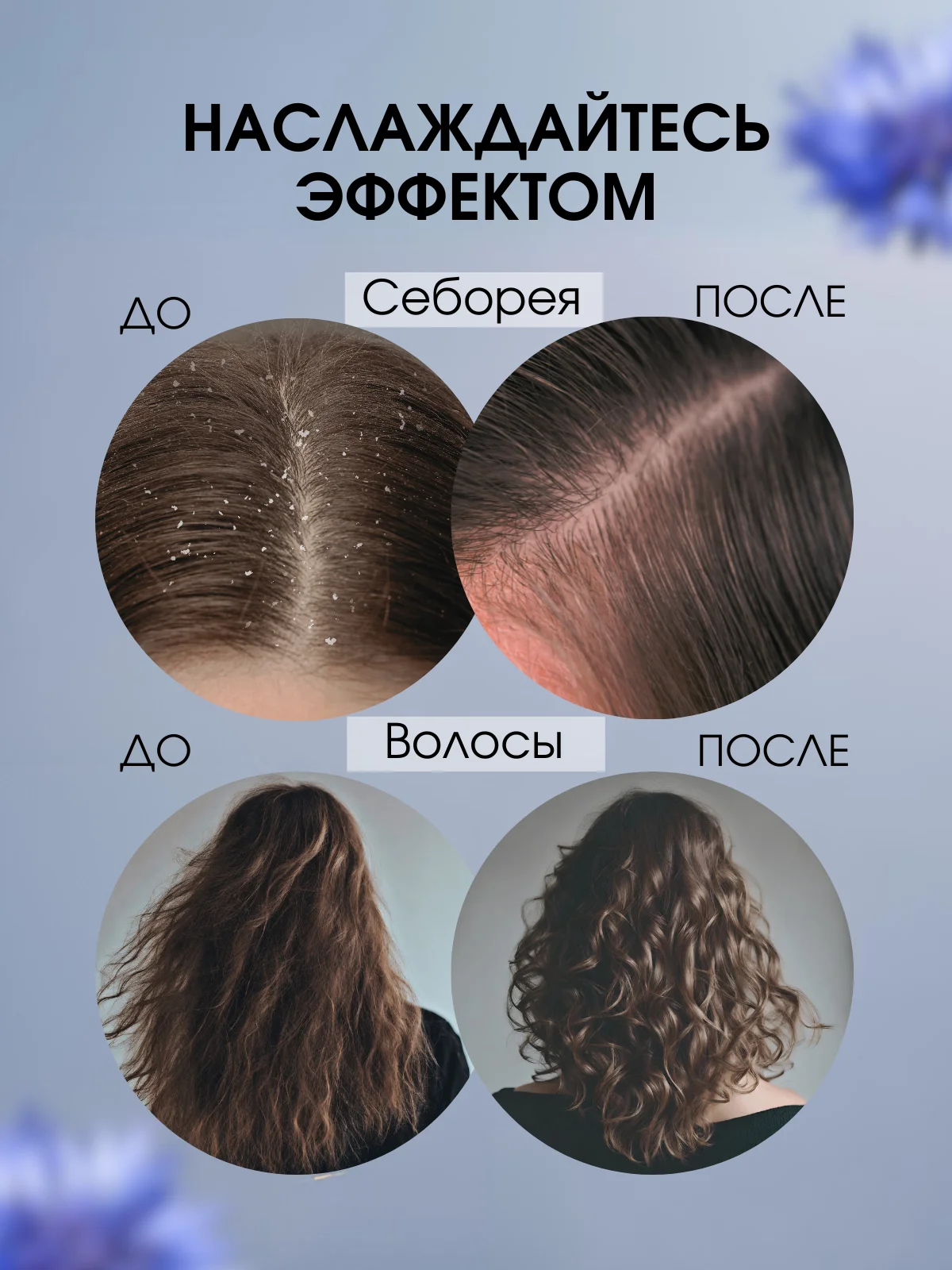 Экстракт Василёк эффективная мазь от прыщей, угрей, капиллярных сеточек и перхоти, 100 г