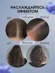 Экстракт Василёк эффективная мазь от прыщей, угрей, капиллярных сеточек и перхоти, 100 г