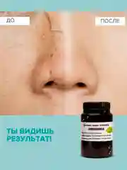 Крем для лица отбеливающий, от веснушек, от прыщей, для проблемной кожи /Эмблика 100г