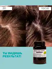 Крем для лица отбеливающий, от веснушек, от прыщей, для проблемной кожи /Эмблика 100г