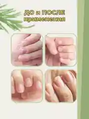 Лечебное средство, масло для кутикулы, масло для лица от отёков и морщин /Хвощ, 12 гр