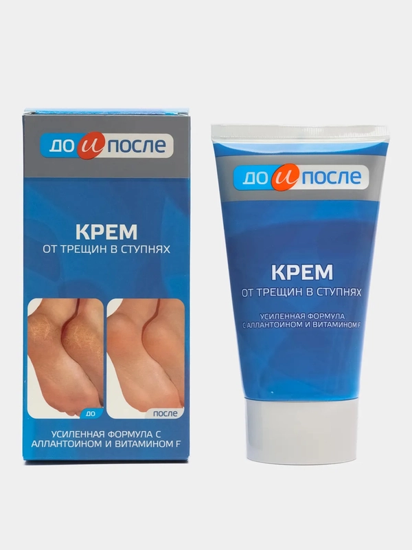 Крем для ног от трещин в ступнях, "До и После", 150 мл