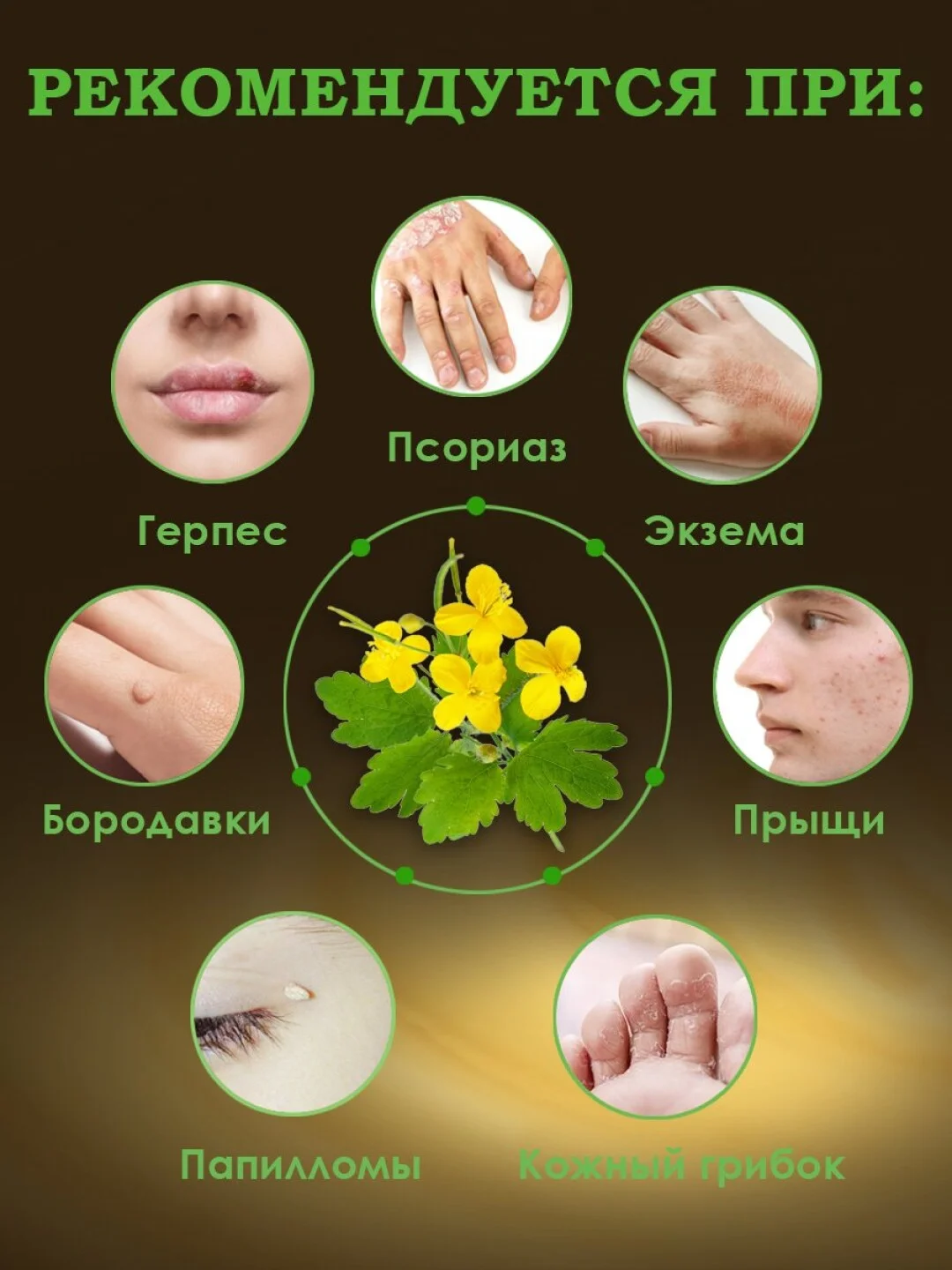 100% Экстракт ЧИСТОТЕЛ средство от мозолей, бородавок, прыщей,псориаза,грибка ногтей 50гр