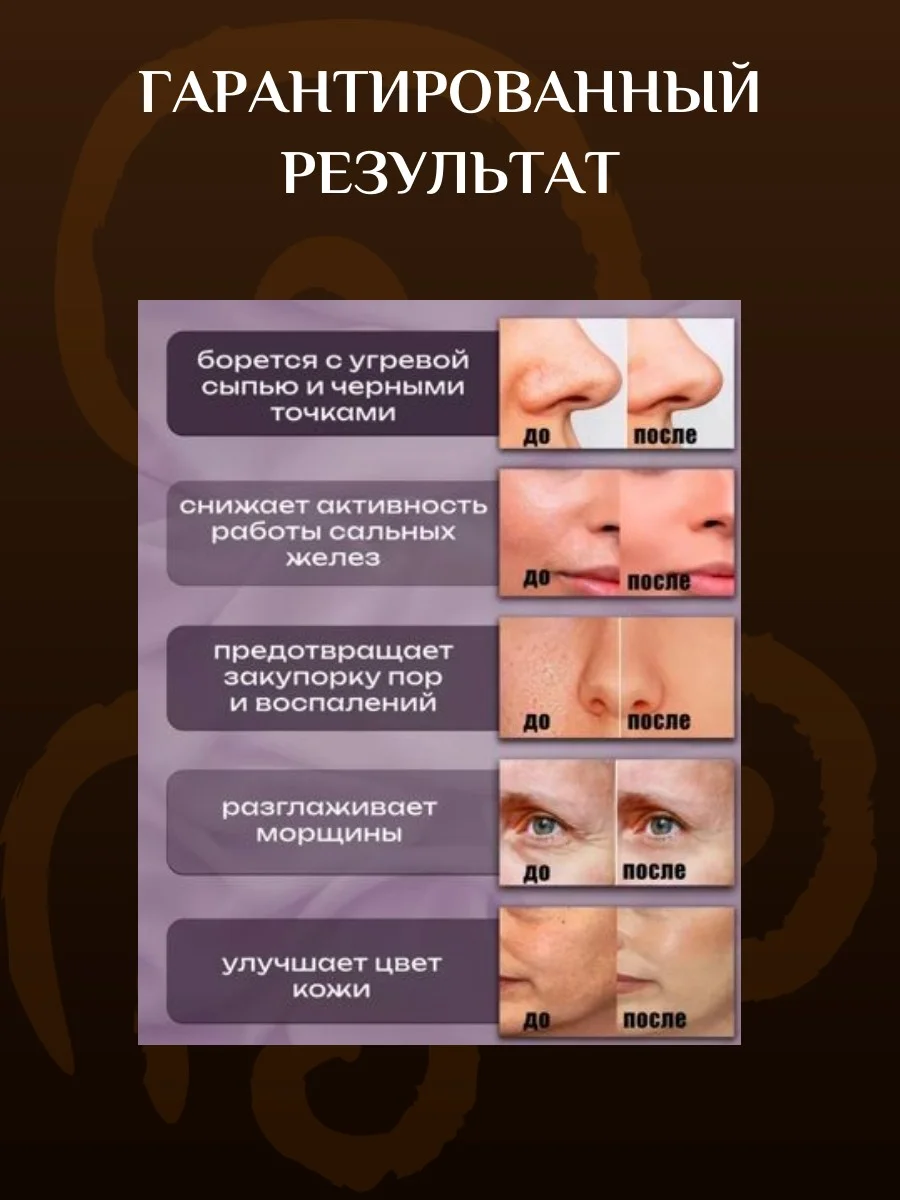 Белый ультразвуковой аппарат для чистки лица
