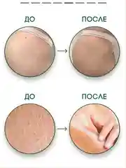 Крем для кожи рук и тела SEMILY увлажняющий, 200 мл