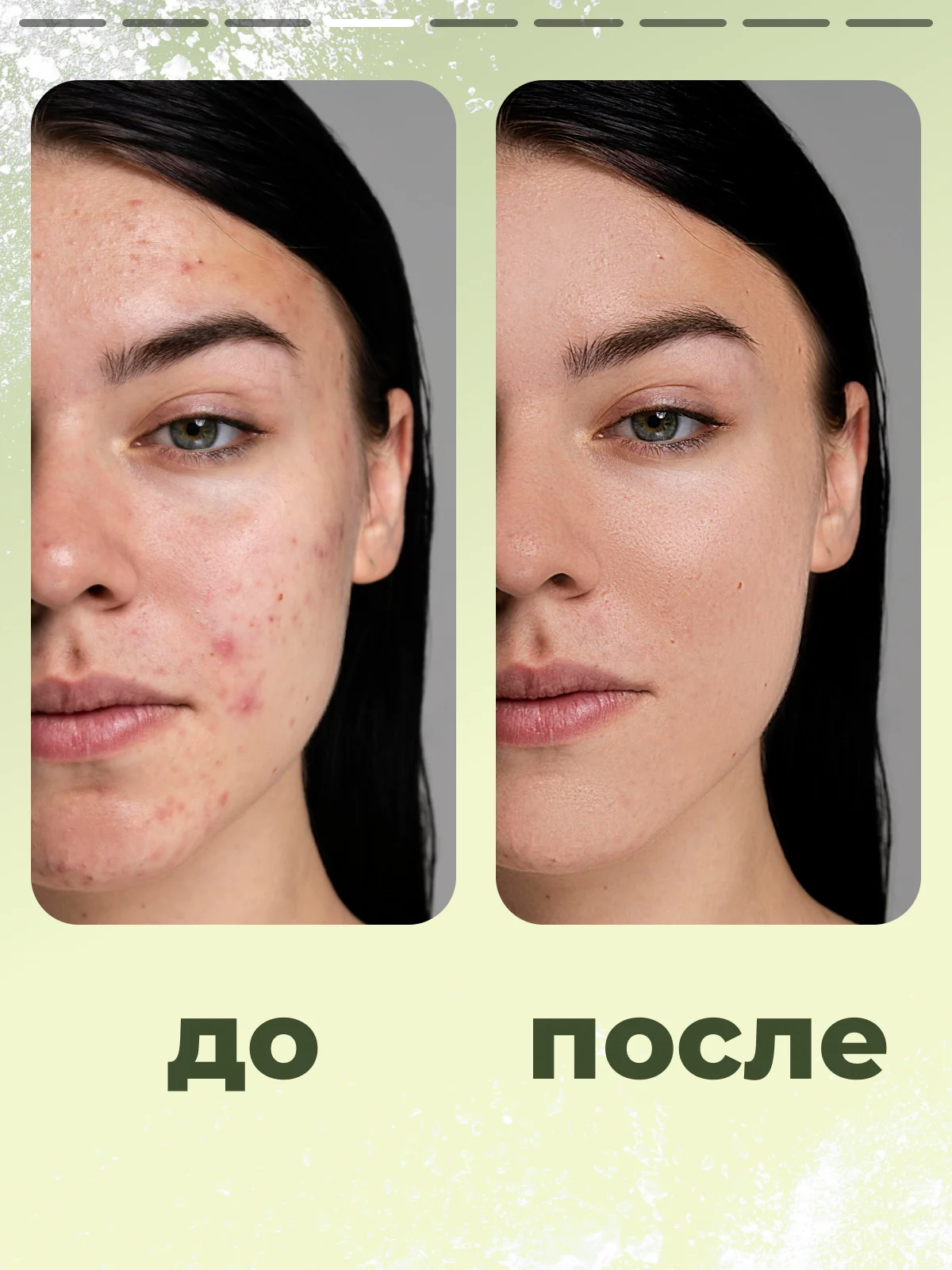 Маска для лица SEMILY, очищающая, от черных точек, 50 мл