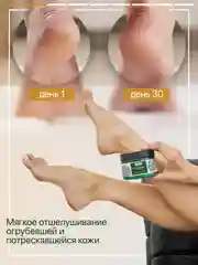 Крем для ног SEMILY, увлажняющий с мочевиной, от трещин и мозолей, 200 мл