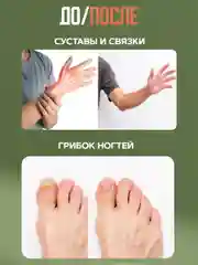 Экстракт "Живица кедра" отложение солей, отёчность ног, трофические язвы, 100 г, воск