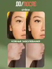 Экстракт "Живица кедра" отложение солей, отёчность ног, трофические язвы, 100 г, воск
