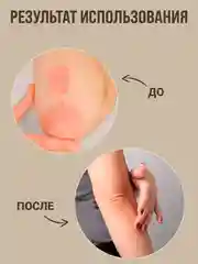 Экстракт от прыщей, угрей, крем воск от трещин,мазь от мозолей/Зелёный грецкий орех 100г,в
