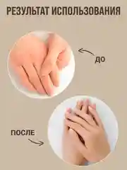 Экстракт от прыщей, угрей, крем воск от трещин,мазь от мозолей/Зелёный грецкий орех 100г,в
