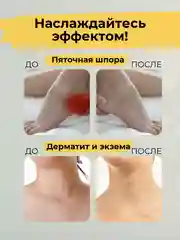 Масляный экстракт маклюра ЛЕЧИТ суставы, артрит, артроз, полиартрит 100гр на воске