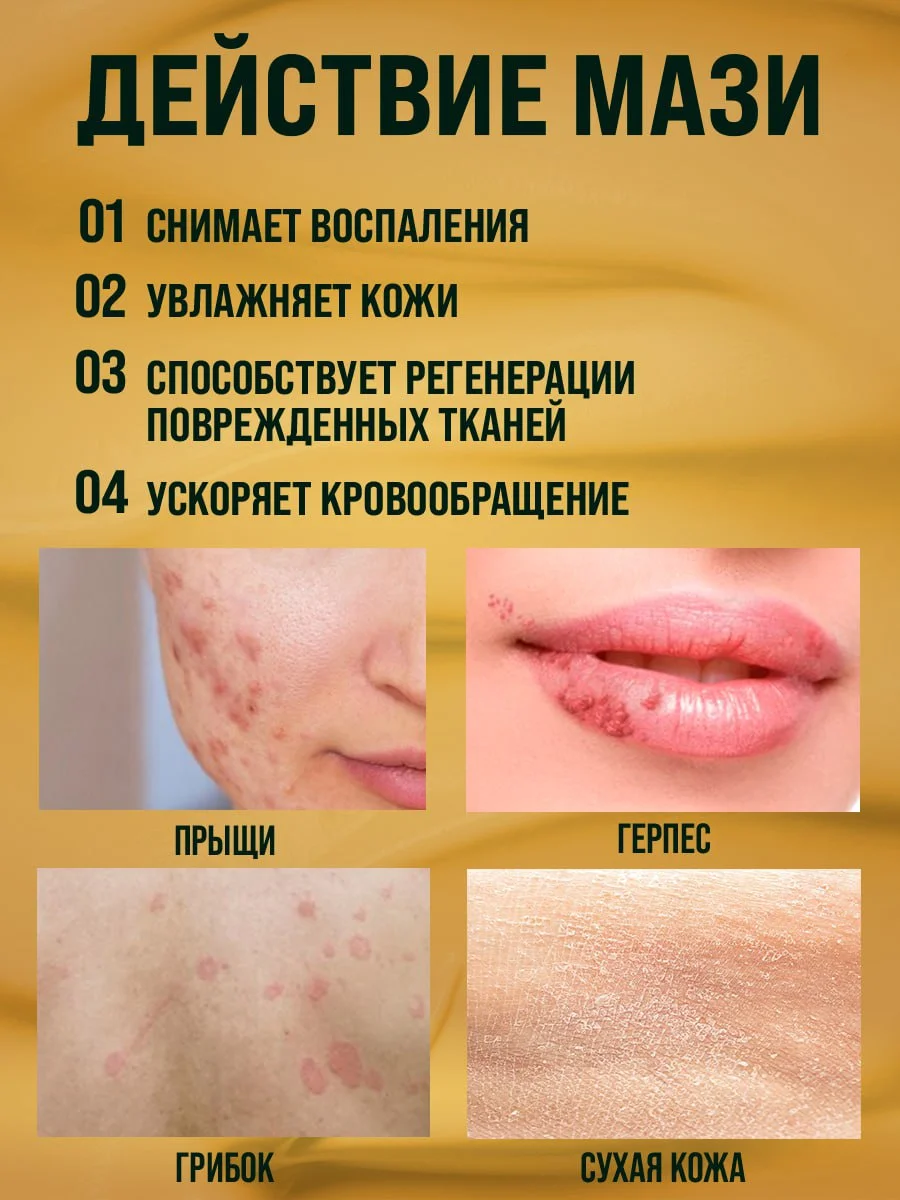 Крем от прыщей "Зеленый орех", мазь от псориаза, от экземы, герпеса / 108 трав, 100 г