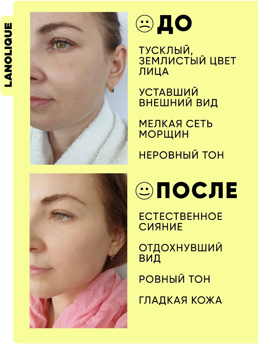 Сыворотка для лица увлажняющая с витамином С ANTIOX, 30 мл