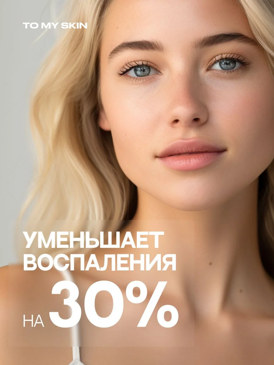 Сыворотка для лица с ниацинамидом от прыщей и акне, 30 мл