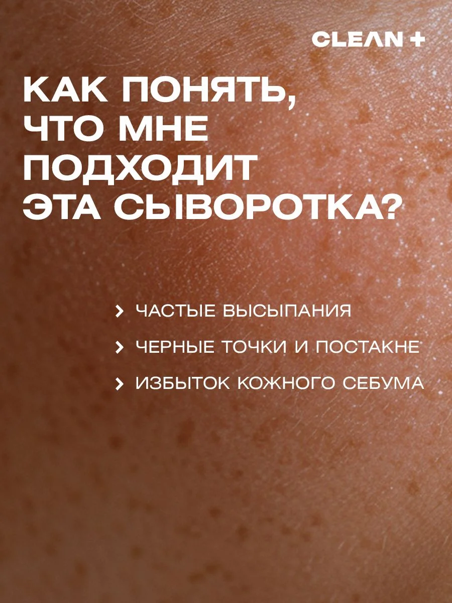Сыворотка для лица от прыщей ниацинамид ACNE CONTROL, 30 мл